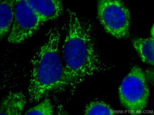 OXCT1 Antibody in Immunocytochemistry (ICC/IF)