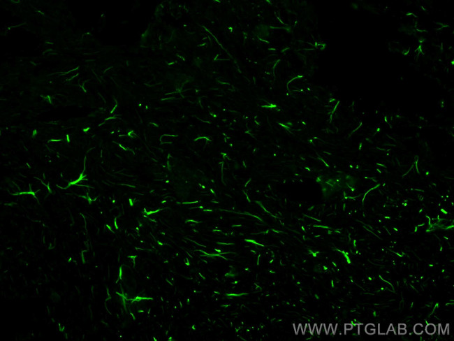 GFAP Antibody in Immunohistochemistry (Paraffin) (IHC (P))