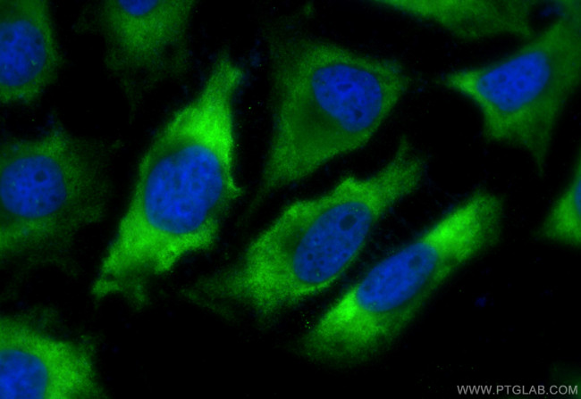 FASN Antibody in Immunocytochemistry (ICC/IF)