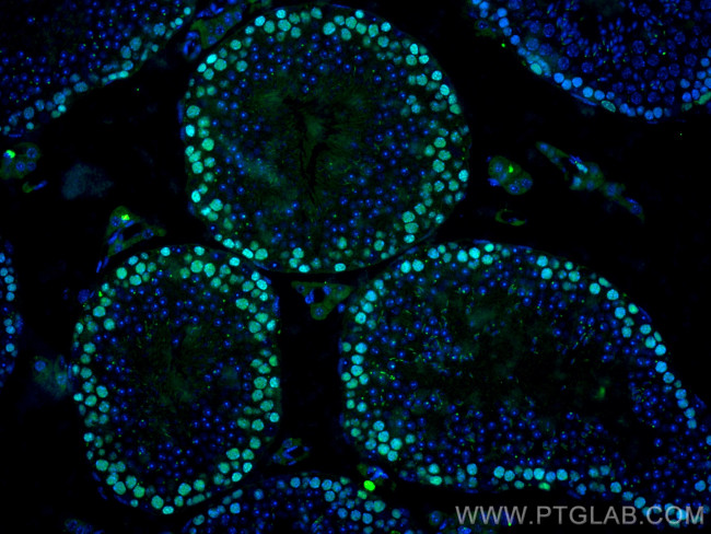 PCNA Antibody in Immunohistochemistry (Paraffin) (IHC (P))