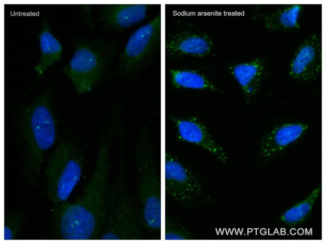YTHDF2 Antibody in Immunocytochemistry (ICC/IF)