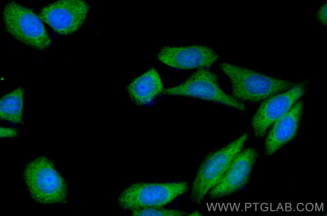 ENO1 Antibody in Immunocytochemistry (ICC/IF)