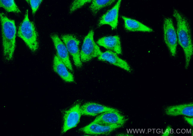 PSAT1 Antibody in Immunocytochemistry (ICC/IF)