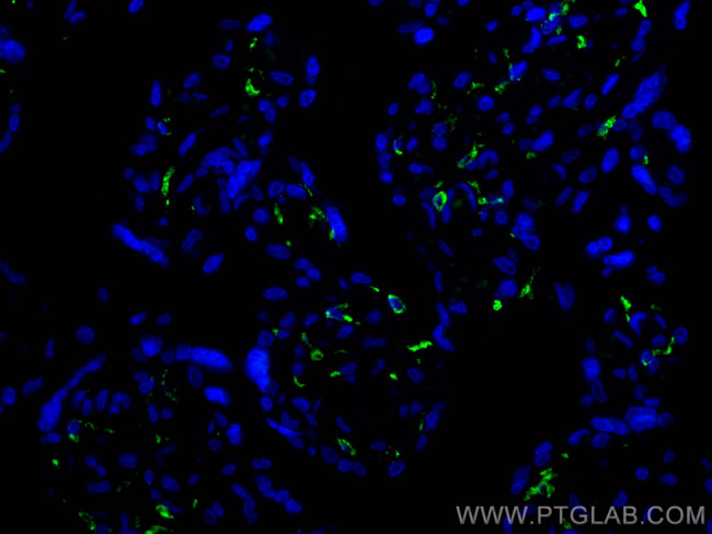 CD206 Antibody in Immunohistochemistry (PFA fixed) (IHC (PFA))