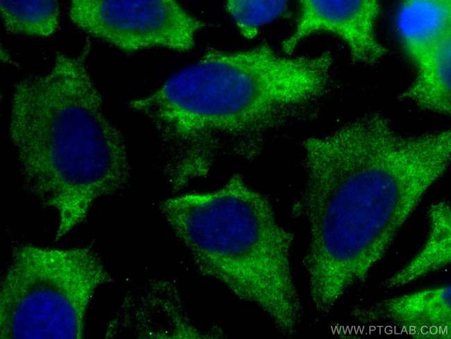 DRP1 Antibody in Immunocytochemistry (ICC/IF)