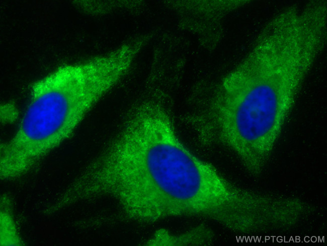 pan-RAS Antibody in Immunocytochemistry (ICC/IF)