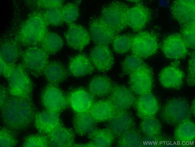 JNK Antibody in Immunocytochemistry (ICC/IF)