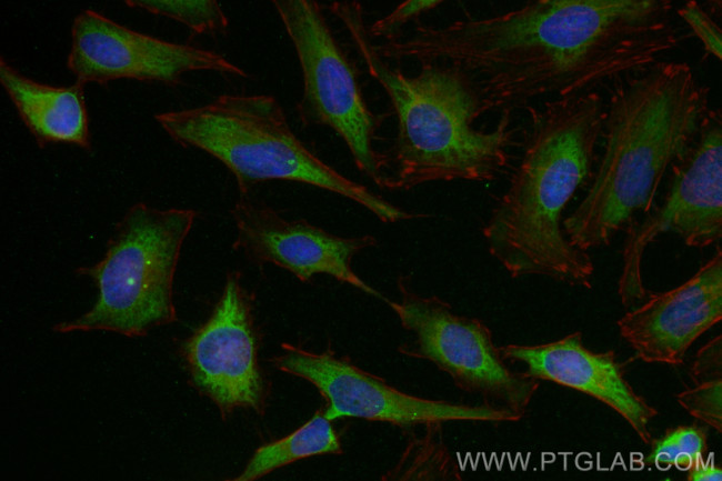 GAPDH Antibody in Immunocytochemistry (ICC/IF)