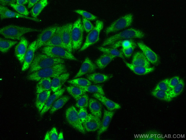 ATG7 Antibody in Immunocytochemistry (ICC/IF)