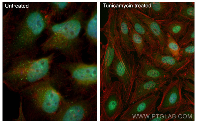 ATF4 Antibody in Immunocytochemistry (ICC/IF)
