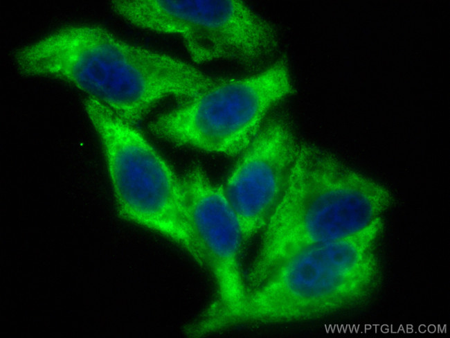 DDX3 Antibody in Immunocytochemistry (ICC/IF)