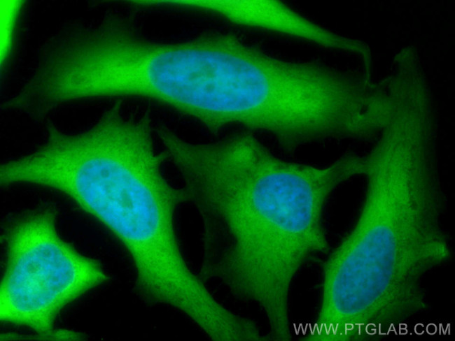 LDHB Antibody in Immunocytochemistry (ICC/IF)