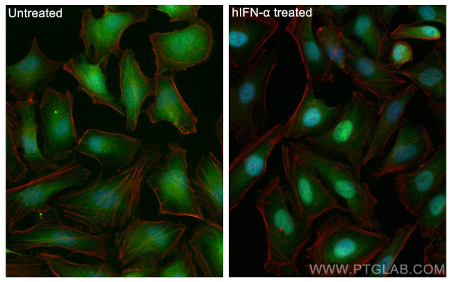 STAT1 Antibody in Immunocytochemistry (ICC/IF)