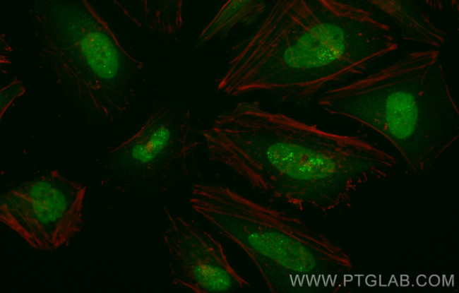 Galectin-3 Antibody in Immunocytochemistry (ICC/IF)