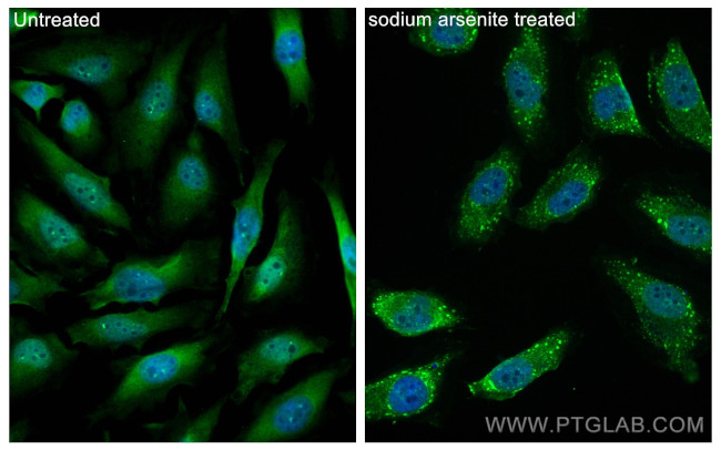 G3BP2 Antibody in Immunocytochemistry (ICC/IF)