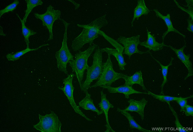SLC7A11/xCT Antibody in Immunocytochemistry (ICC/IF)