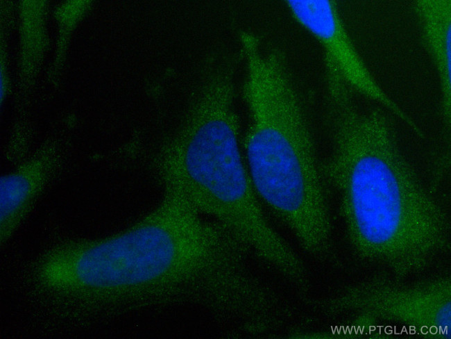 Caspase 3 Antibody in Immunocytochemistry (ICC/IF)