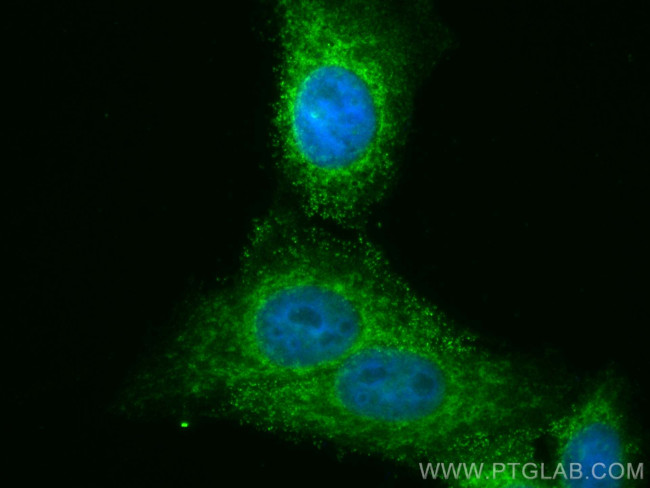 FIS1 Antibody in Immunocytochemistry (ICC/IF)
