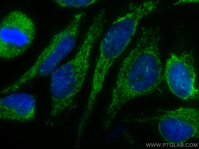 ATP5A1 Antibody in Immunocytochemistry (ICC/IF)