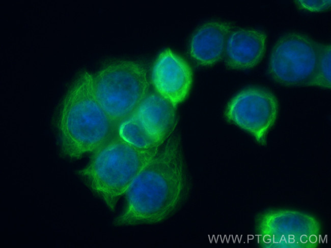 Cytokeratin 20 Antibody in Immunocytochemistry (ICC/IF)