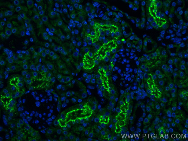 Cystatin C Antibody in Immunohistochemistry (PFA fixed) (IHC (PFA))
