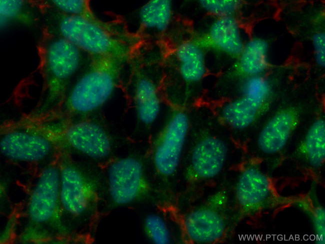CUL1 Antibody in Immunocytochemistry (ICC/IF)