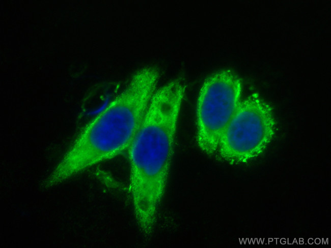 KIF5B Antibody in Immunocytochemistry (ICC/IF)