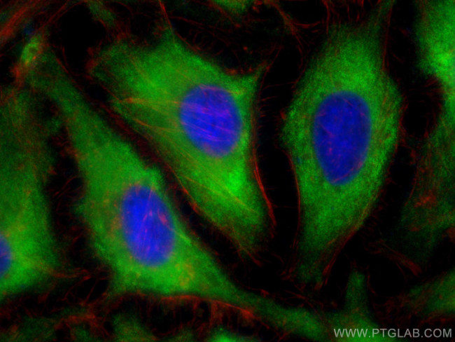 Stathmin 1 Antibody in Immunocytochemistry (ICC/IF)