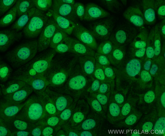 P21 Antibody in Immunocytochemistry (ICC/IF)