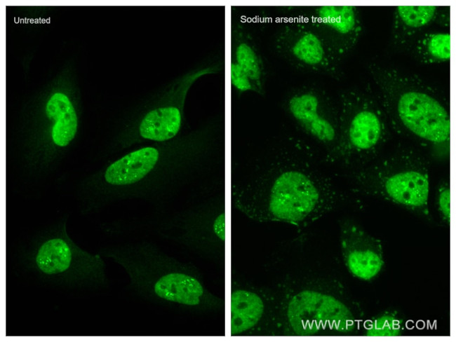 TIA1 Antibody in Immunocytochemistry (ICC/IF)