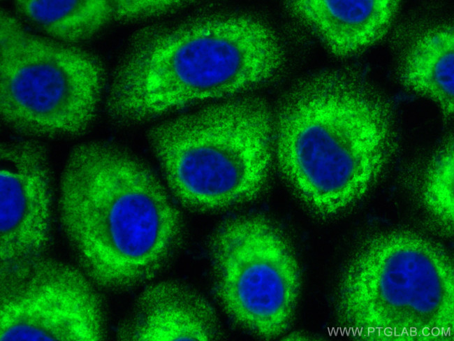 MX1 Antibody in Immunocytochemistry (ICC/IF)