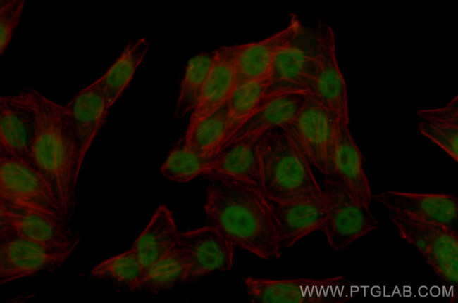 Cyclin E Antibody in Immunocytochemistry (ICC/IF)