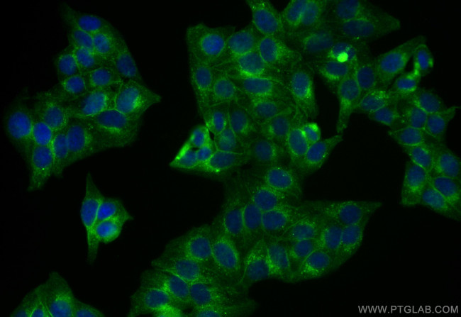 BST2 Antibody in Immunocytochemistry (ICC/IF)