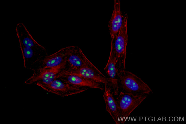 BOP1 Antibody in Immunocytochemistry (ICC/IF)