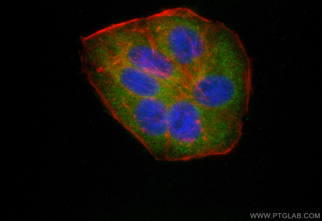 UPF1 Antibody in Immunocytochemistry (ICC/IF)