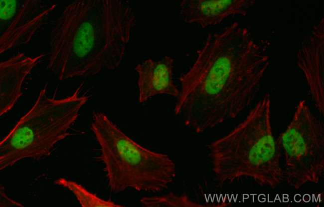 HNRNPC Antibody in Immunocytochemistry (ICC/IF)