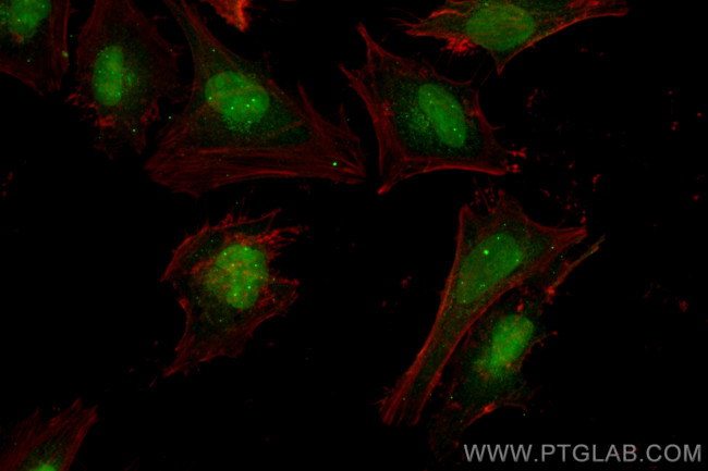 MSH3 Antibody in Immunocytochemistry (ICC/IF)