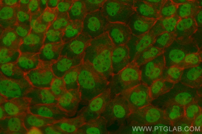 FBXO44 Antibody in Immunocytochemistry (ICC/IF)