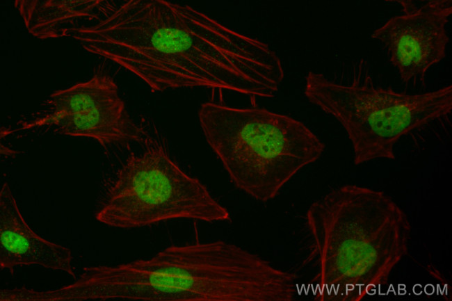 TAF15 Antibody in Immunocytochemistry (ICC/IF)