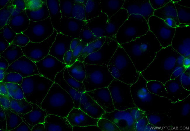 ZO-1 Antibody in Immunocytochemistry (ICC/IF)