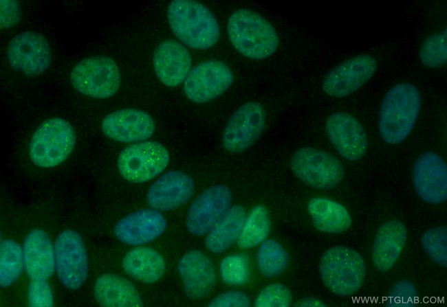 PIAS1 Antibody in Immunocytochemistry (ICC/IF)
