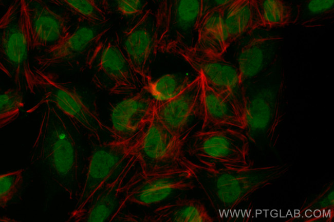 MYCL1 Antibody in Immunocytochemistry (ICC/IF)