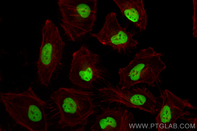 Emerin Antibody in Immunocytochemistry (ICC/IF)