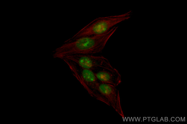 NSUN2 Antibody in Immunocytochemistry (ICC/IF)