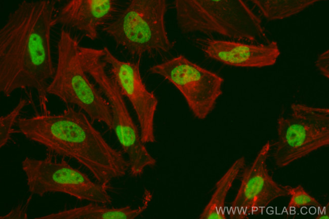 FANCM Antibody in Immunocytochemistry (ICC/IF)