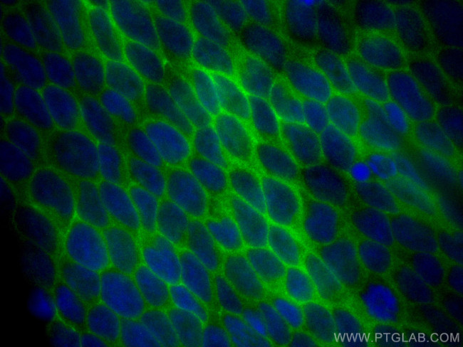 LAT Antibody in Immunocytochemistry (ICC/IF)