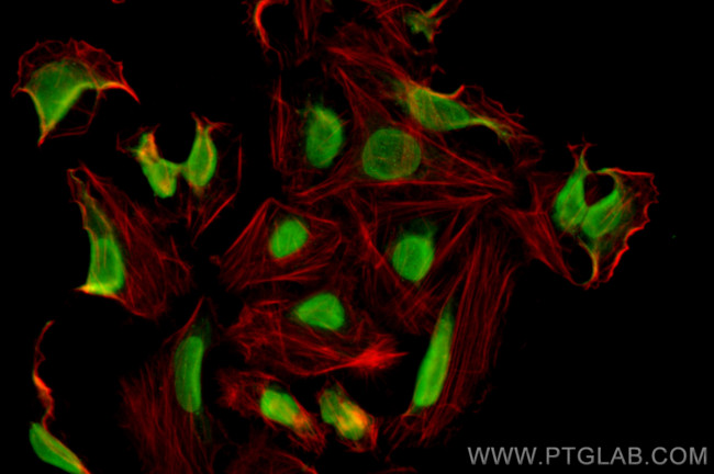 BAZ2A Antibody in Immunocytochemistry (ICC/IF)