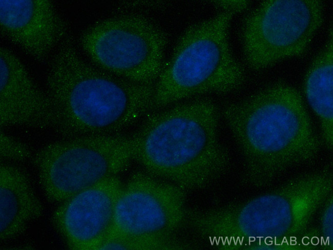 TBCD Antibody in Immunocytochemistry (ICC/IF)