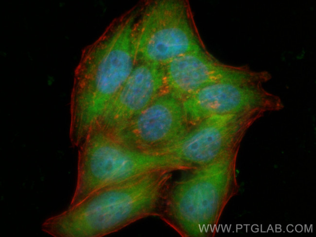 PARK7/DJ-1 Antibody in Immunocytochemistry (ICC/IF)