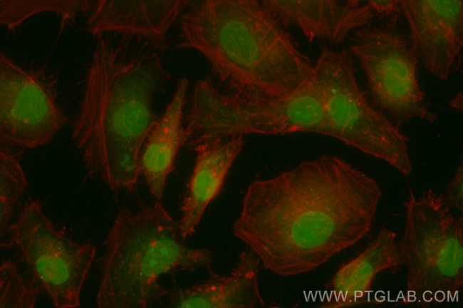 NFX1 Antibody in Immunocytochemistry (ICC/IF)